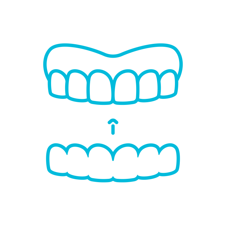 Invisalign Invisalign